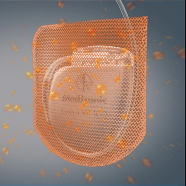 Press Release: Medtronic's WRAP-IT Trial Data Suggest That TYRX™ Absorbable Antibacterial Envelope is Cost Effective for Patients
